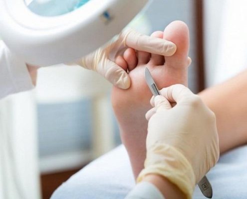 massaggio piedi | pedicure | sun lovers group
