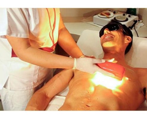 laser uomo | epilazione uomo | padova | venezia