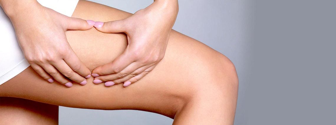 come si forma la cellulite? | sun lovers group